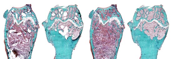 Medical Illustration: Photomicroscopy example